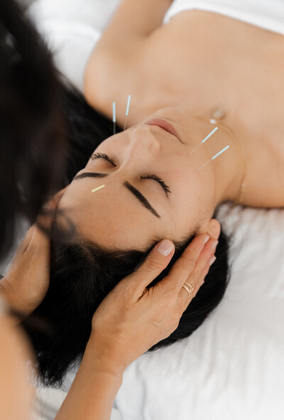 Cosmetic Acupuncture Halifax, NS